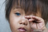 Balita dengan bola mata berwarna biru Amelia Anggraeni bermain di teras rumah di kawasan Bandung, Jawa Barat, Sabtu (7/9/2019). Menurut Dokter yang memeriksa kondisi kesehatan mata balita berusia 2,5 tahun tersebut warna biru hingga abu dan coklat pada bola matanya akibat perbedaan sel melanosit atau pigmen pada mata namun tidak mempengaruhi kondisi penglihatannya. ANTARA FOTO/Novrian Arbi/agr