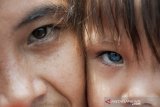 Reni Nuryani (kiri) menggendong anaknya yang memiliki bola mata berwarna biru di teras rumah di kawasan Bandung, Jawa Barat, Sabtu (7/9/2019). Menurut Dokter yang memeriksa kondisi kesehatan mata balita berusia 2,5 tahun tersebut warna biru hingga abu dan coklat pada bola matanya akibat perbedaan sel melanosit atau pigmen pada mata namun tidak mempengaruhi kondisi penglihatannya. ANTARA FOTO/Novrian Arbi/agr