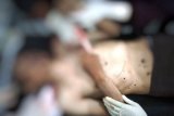 Tiga tukang ojek meninggal ditembak kelompok kriminal bersenjata
