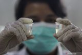 Peneliti dari Professor Nidom Foundation (PNF) menunjukkan cairan struktur pernafasan (respirasi) kelelawar asal Kepulauan Riau di Surabaya, Jawa Timur, Senin (10/2/2020). Penelitian respirasi kelelawar tersebut untuk memastikan apakah di dalamnya terdapat virus corona 2019-n CoV dan kemungkinan untuk dibuatkan vaksin pada tahapan proses penelitian berikutnya. Antara Jatim/Moch Asim/zk.