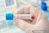 Peserta ijtima Gowa asal Barsel terindikasi terpapar COVID-19 dari hasil rapid test