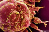 Pakar Biologi: Mutasi COVID-19 yang sangat cepat sulitkan pembuatan vaksin