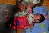Seorang Ibu merawat anaknya Muhammad Jumadil Ardiansyah (9) yang didiagnosa menderita gizi buruk di rumahnya di Tungkal Ilir, Tanjungjabung Barat, Jambi, Sabtu (27/6/2020). Data Dinas Kesehatan Provinsi Jambi tahun 2020 menyebutkan hingga April tahun ini telah ditemukan sebanyak 34 pasien gizi buruk di provinsi itu. ANTARA FOTO/Wahdi Septiawan/hp. 