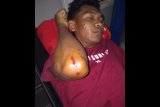 Asyik nongkrong berduaan di kuburan tiba-tiba diserang empat pemuda bermasker hingga babak belur