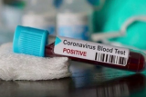 Update COVID-19 di Indonesia: 83.710 pasien sembuh, 128.776 kasus positif