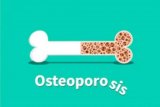 Dokter sebut wanita lebih berisiko terkena osteoporosis