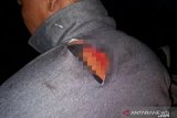 Kepala BNNK Pasaman Barat dibacok saat manangkap tersangka diduga pengedar ganja
