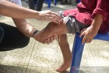 BANTUAN KAKI PALSU UNTUK PENYANDANG DISABILITAS ACEH. Relawan mengukur kaki penyandang disabilitas untuk pembuatan kaki palsu di Banda Aceh, Aceh, Rabu (24/3/2021).  Sekitar 221 penyandang disabilitas yang mendaftar membutuhkan bantuan kaki palsu di Aceh, hanya sekitar 15 persen yang dapat terpenuhi atas bantuan dari lembaga donor Blood For Life Foundation, sedangkan sisanya mengharapkan bantuan kaki palsu dari pemerintah Aceh. ANTARA FOTO/Ampelsa.