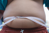 Obesitas awal pada anak dapat kurangi setengah harapan hidup
