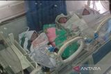 Dirut RS Komaling: Bayi kembar 4 Minsel, dua meninggal