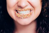 Makanan berserat bantu kurangi risiko gigi berlubang saat puasa