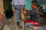 Pekerja dari Forum Komunikasi Penyandang Cacat Indramayu (FKPCI) menyesuaikan ukuran kaki pasien yang akan membuat protesha atau alat bantu Kaki palsu di Indramayu, Jawa Barat, Kamis (2/2/2023). Alat bantu kaki palsu tersebut dipasarkan ke sejumlah wilayah di Jawa Barat dengan harga dua juta rupiah hingga tujuh juta rupiah per unit tergantung ukuran dan kualitas bahan kaki palsu. ANTARA FOTO/Dedhez Anggara/agr