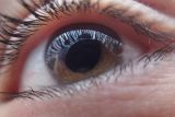 Curiga kena glaukoma? Coba langkah ini