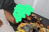 Ngeri! akibat petasan, telapak tangan warga Batukliang Loteng hancur