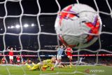 Mikel Arteta: Lupakan kekalahan dari Manchester City