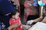 Dinkes Tangerang: Penyakit polio bisa dicegah dengan imunisasi dasar
