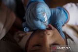 Solo targetkan 50.115 anak terima vaksin polio