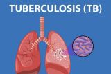 Tips beri obat TBC pada anak, berikan saat perut kosong