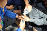 Damkarmat Lamsel evakuasi cincin di jari remaja pria 16 tahun