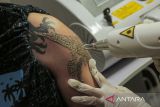 Petugas menghapus tato dengan laser di RS Bhayangkara Setukpa, Kota  Sukabumi, Jawa Barat, Rabu (26/6/2024). Layanan hapus tato gratis yang digelar oleh RS Bhayangkara Setukpa tersebut merupakan rangkaian kegiatan bakti kesehatan dalam rangka memeriahkan Hari Bhayangkara ke-78. ANTARA FOTO/Henry Purba/agr
