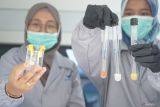 Petugas Badan Pengawas Obat dan Makanan (BPOM) menunjukkan hasil uji sampel makanan pada program Makan Bergizi Gratis (MBG) di Tulungagung, Jawa Timur, Senin (6/1/2025). Pemeriksaan secara acak dilakukan untuk memastikan seluruh paket makanan dalam program MBG yang diberikan kepada siswa layak konsumsi dan tidak mengandung bakan kimia berbahaya seperti boraks, ormalin dan rhodamin B. Antara Jatim/Destyan Sujarwoko/um