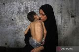 100 ribu anak di Jalur Gaza sedang hadapi kematian