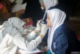 Petugas tenaga medis memeriksa kesehatan gigi dan mulut santri saat peluncuran program Cek Kesehatan Gratis (CKG) di Pondok Pesantren (Ponpes) Al-Amanah Junwangi di Sidoarjo, Jawa Timur, Senin (4/8/2025). Pelaksanaan CKG yang digelar pemerintah secara serentak di sekolah seluruh Indonesia dengan target sebanyak 53,8 juta peserta didik pada tahun 2025 itu sebagai upaya mendeteksi penyakit lebih awal agar dapat diberikan penanganan yang tepat dan mencegah komplikasi sekaligus menyosialisasikan membangun kebiasaan hidup sehat sejak dini. Antara Jatim/Umarul Faruq