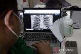 Petugas melakukan pemeriksaan Chest X-Ray (CXR) kepada warga binaan di Lapas Kelas IIB Indramayu, Jawa Barat, Rabu (15/10/2025). Skrining TBC yang digelar Kementerian Kesehatan dan Lapas Kelas IIB Indramayu itu untuk menjaga kesehatan warga binaan serta mendukung program pemerintah menuju eliminasi penyakit TBC di lingkungan pemasyarakatan. ANTARA FOTO/Dedhez Anggara/agr