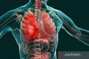Dokter sarankan kebiasaan baik untuk mengurangi peradangan