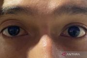 Mengenal Ptosis, kondisi mata telihat "ngantuk" menurut medis&nbsp;