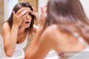 Chemical peeling efektif tangani masalah jerawat hingga stretch mark