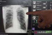 Pemkot Pekalongan mempercepat deteksi dini TBC guna cegah penularan