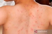 Kemenkes tanggapi perilaku influencer kena campak, tapi keluar rumah