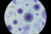 Swiss konfirmasi kasus hantavirus terkait kapal pesiar