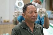 Transplantasi rambut perlu dilakukan bertahap sesuai kondisi donor