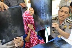 PENYELUNDUPAN HASHIS DALAM PERUT