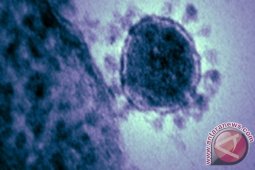 Warga Aceh Tidak Terpengaruh Dengan Virus Mers