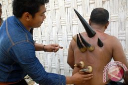 Terapi Bekam Menggunakan Tanduk Sapi