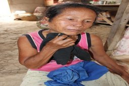 Penderita Tumor Memerlukan Bantuan Biaya Operasi