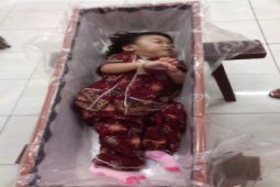 Sasa Bayi Dempet Asal Landak Meninggal Dunia