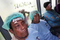 Operasi Katarak Gratis