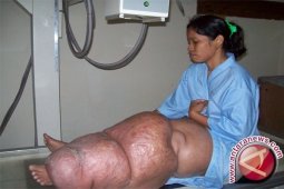 Dinkes Paser Kerahkan 1.200 Kader Sosialisasi "Filariasis"
