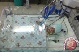Bayi Kembar Siam Sidoarjo Pascaoperasi Masih Kritis