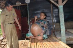 Seorang Warga Karawang "Tersiksa" Akibat Menderita Asites