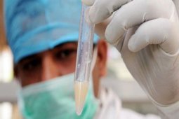 Paparan polusi udara jangka panjang berisiko turunkan kesuburan pria