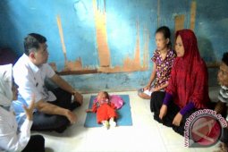 Pemkot Jambi bantu bayi penderita tumor mata