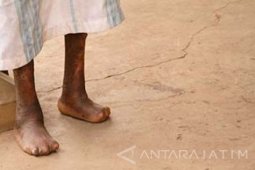 Dinkes Tulungagung Temukan 20 Penderita Lepra Baru