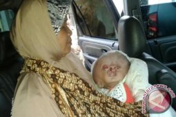Pemkab Sukabumi Bantu Pengobatan Bayi Hydrocephalus