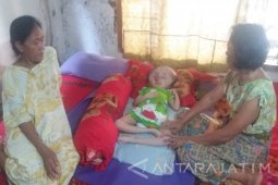 10 Tahun Penderita Hidrosefalus di Situbondo Terbaring (Video)