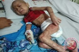 Tio, Bocah Asal Toba Yang Butuh Bantuan